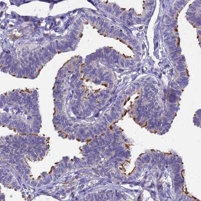 Immunohistochemistry-Paraffin: POP7 Antibody [NBP1-92282]