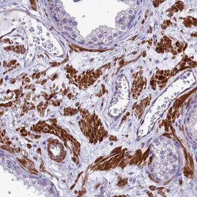 Immunohistochemistry-Paraffin: POP7 Antibody [NBP1-92282]