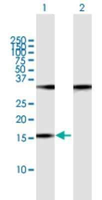 Western Blot: POP7 Antibody [H00010248-B01P]