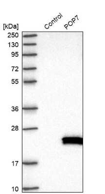 Western Blot: POP7 Antibody [NBP1-92282]