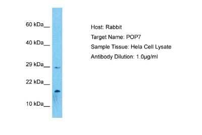 Western Blot: POP7 Antibody [NBP2-88073]