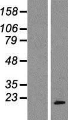 Western Blot: POP7 Overexpression Lysate [NBP2-07694]