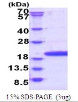 SDS-PAGE: Recombinant Human POP7 His Protein [NBP2-51761]