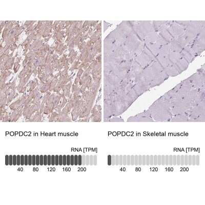 Immunohistochemistry-Paraffin: POPDC2 Antibody [NBP1-87256]
