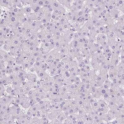 Immunohistochemistry-Paraffin: POPDC2 Antibody [NBP1-87256]