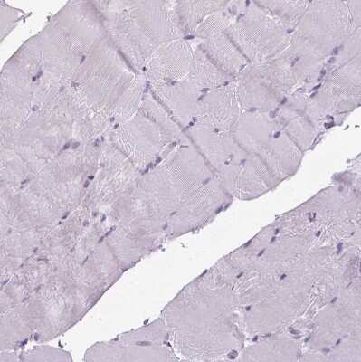 Immunohistochemistry-Paraffin: POPDC2 Antibody [NBP1-87256]