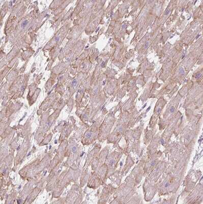 Immunohistochemistry-Paraffin: POPDC2 Antibody [NBP1-87256]