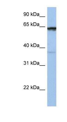 Western Blot: POPDC2 Antibody [NBP1-60108]