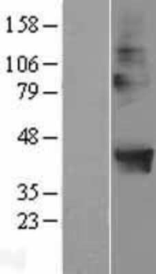 Western Blot: POPDC2 Overexpression Lysate [NBL1-14609]