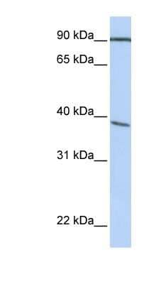 Western Blot: POPDC3 Antibody [NBP1-59476]