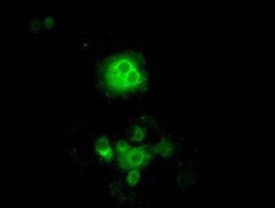 Immunocytochemistry/ Immunofluorescence: POR/Cytochrome P450 Reductase Antibody (OTI3F10) [NBP1-47914]