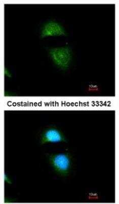 Immunocytochemistry/ Immunofluorescence: POR/Cytochrome P450 Reductase Antibody [NBP1-32364]