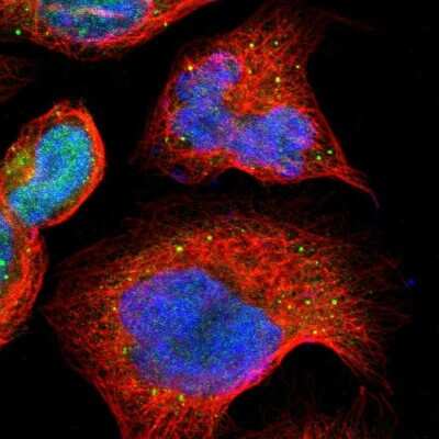 Immunocytochemistry/ Immunofluorescence: POR/Cytochrome P450 Reductase Antibody [NBP1-85357]