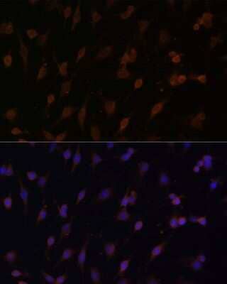 Immunocytochemistry/ Immunofluorescence: POR/Cytochrome P450 Reductase Antibody - BSA Free [NBP3-03396]
