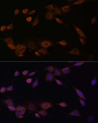Immunocytochemistry/ Immunofluorescence: POR/Cytochrome P450 Reductase Antibody - BSA Free [NBP3-03396]