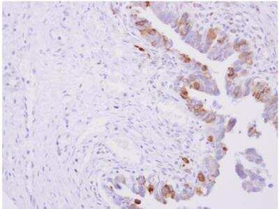 Immunohistochemistry-Paraffin: POR/Cytochrome P450 Reductase Antibody [NBP1-32364]