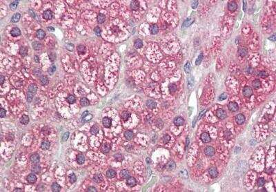 Immunohistochemistry-Paraffin: POR/Cytochrome P450 Reductase Antibody [NBP1-52083]