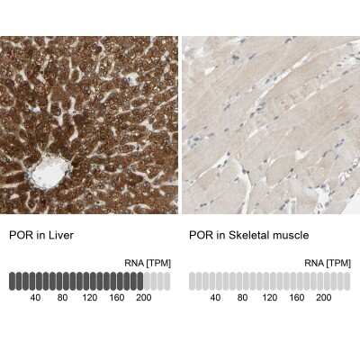 Immunohistochemistry-Paraffin: POR/Cytochrome P450 Reductase Antibody [NBP1-85357]