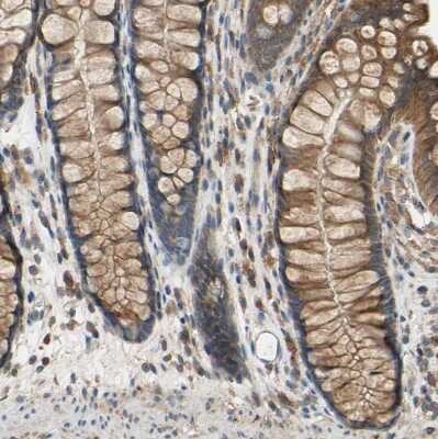 Immunohistochemistry-Paraffin: POR/Cytochrome P450 Reductase Antibody [NBP1-85357]