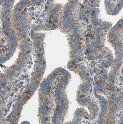 Immunohistochemistry-Paraffin: POR/Cytochrome P450 Reductase Antibody [NBP1-85357]