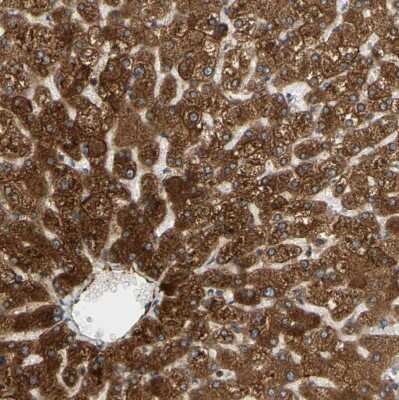 Immunohistochemistry-Paraffin: POR/Cytochrome P450 Reductase Antibody [NBP1-85357]