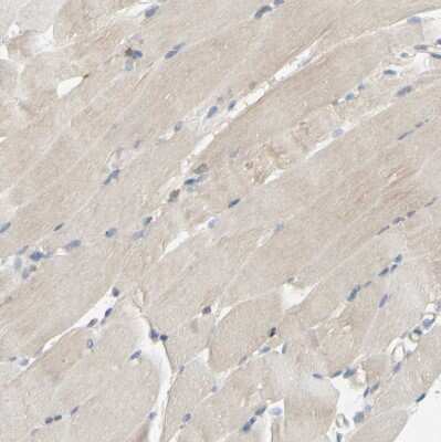 Immunohistochemistry-Paraffin: POR/Cytochrome P450 Reductase Antibody [NBP1-85357]