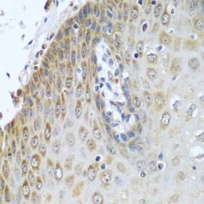 Immunohistochemistry-Paraffin: POR/Cytochrome P450 Reductase Antibody - BSA Free [NBP3-03396]
