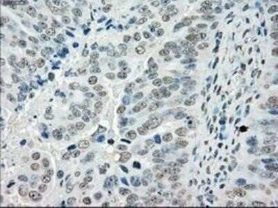 Immunohistochemistry: POR/Cytochrome P450 Reductase Antibody (OTI3F10) - Azide and BSA Free [NBP2-73539]