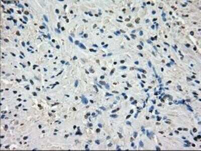 Immunohistochemistry: POR/Cytochrome P450 Reductase Antibody (OTI3F10) - Azide and BSA Free [NBP2-73539]