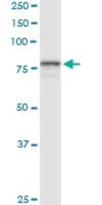 Western Blot: POR/Cytochrome P450 Reductase Antibody [H00005447-D01P]