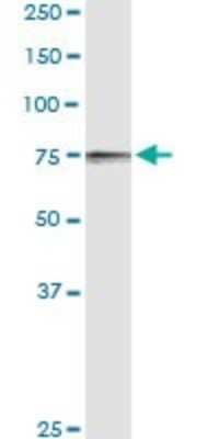 Western Blot: POR/Cytochrome P450 Reductase Antibody [H00005447-D01P]