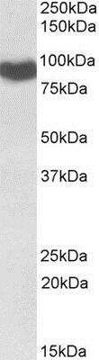 Western Blot: POR/Cytochrome P450 Reductase Antibody [NBP1-52083]