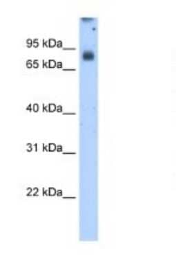 Western Blot: POR/Cytochrome P450 Reductase Antibody [NBP1-59779]