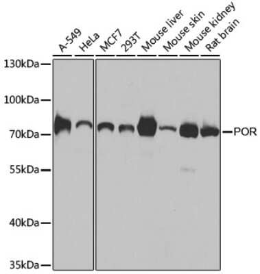 Western Blot: POR/Cytochrome P450 Reductase AntibodyBSA Free [NBP3-03396]