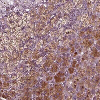 Immunohistochemistry-Paraffin: PORCN Antibody [NBP2-58504]