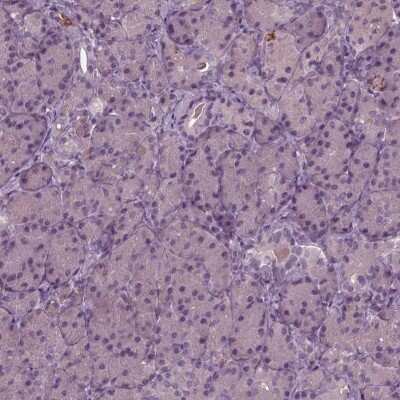 Immunohistochemistry-Paraffin: PORCN Antibody [NBP2-58504]