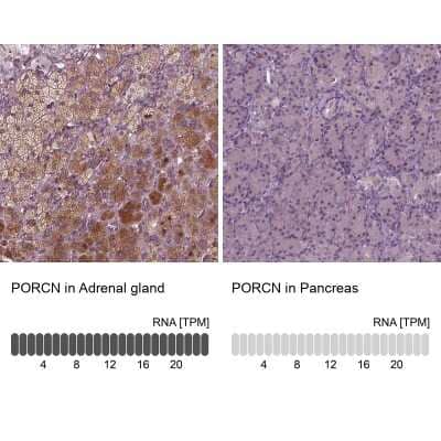 Immunohistochemistry-Paraffin: PORCN Antibody [NBP2-58504]