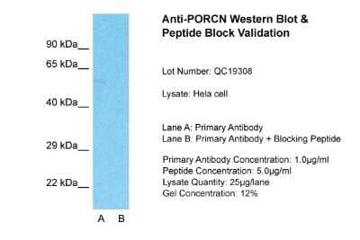 Western Blot: PORCN Antibody [NBP1-59677]