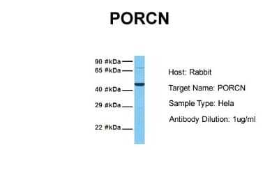 Western Blot: PORCN Antibody [NBP1-59677]