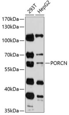 Western Blot: PORCN AntibodyAzide and BSA Free [NBP2-93804]