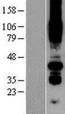 Western Blot: PORCN Overexpression Lysate [NBP2-04454]