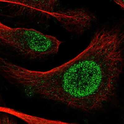 Immunocytochemistry/ Immunofluorescence: POT1 Antibody [NBP2-57891]