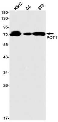 Western Blot: POT1 Antibody (S06-9I1) [NBP3-15080]