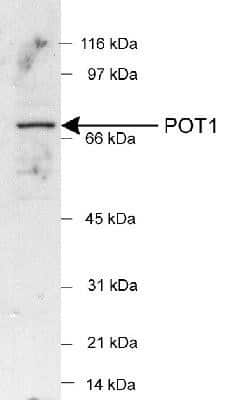 Western Blot: POT1 Antibody [NB500-176]