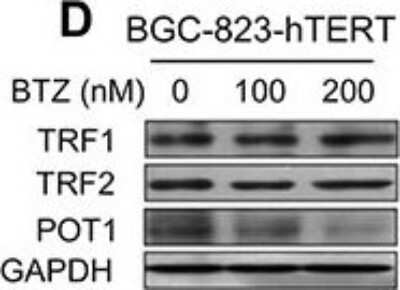 Western Blot: POT1 Antibody [NB500-176]