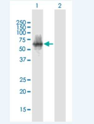 Western Blot: POTEA Antibody [H00340441-B01P-50ug]