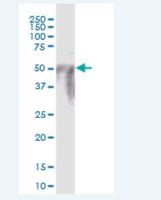Western Blot: POTEA Antibody [H00340441-B01P-50ug]