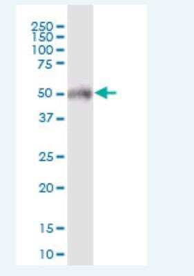 Western Blot: POTEA Antibody [H00340441-B01P-50ug]