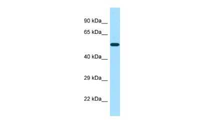 Western Blot: POTEA Antibody [NBP2-84226]