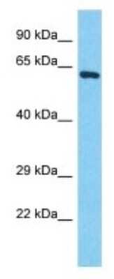 Western Blot: POTEB Antibody [NBP3-09877]